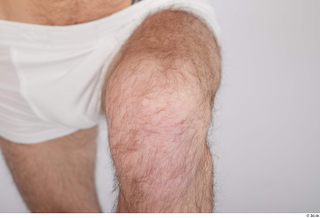 Dio hairy knee nude 0001.jpg